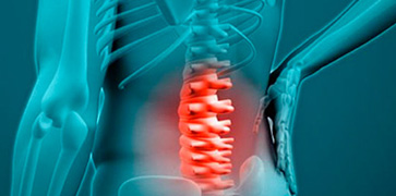 foto de esqueleto de costas com destaque para a região lombar