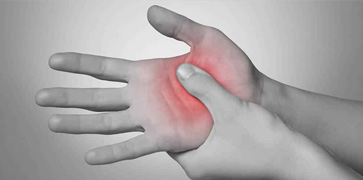 foto em preto e branco da mão direita apertando com o dedão a palma da mão esquerda e uma area avermelhada no ponto de contato